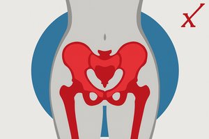 Ein Symbolbild zeigt die Beckenregion